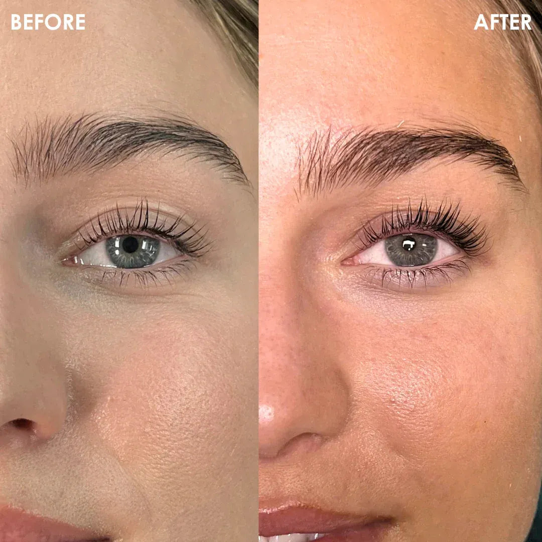 Recupera Años en Tu Mirada SérumElixir™ 2x1